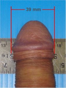 tlc-flaccid-size-example